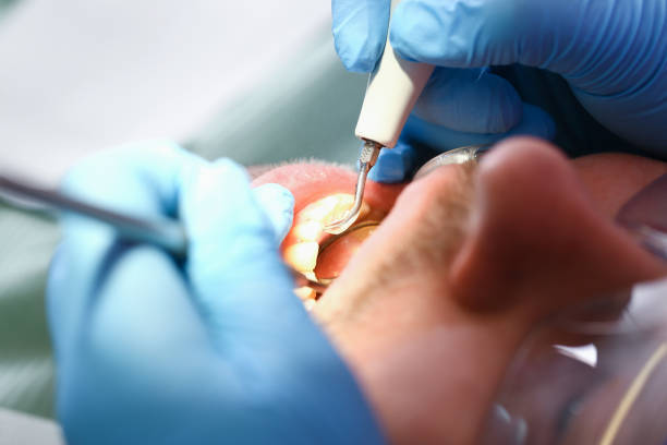Best Tooth Infection Emergency Dentist  in Springdale, NC