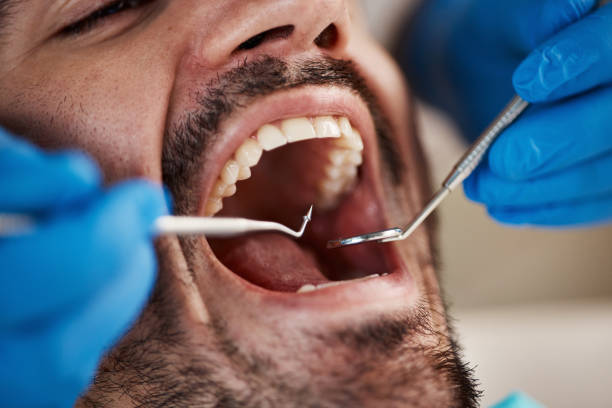 Best Teeth Whitening  in Springdale, NC